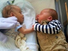 twins birth, preemie twins, Premature birth, babies, miracle, healthy babies, how to make birth easy, easy birth,