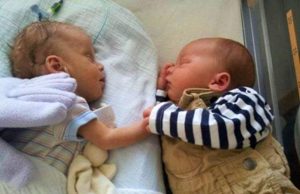 twins birth, preemie twins, Premature birth, babies, miracle, healthy babies, how to make birth easy, easy birth,