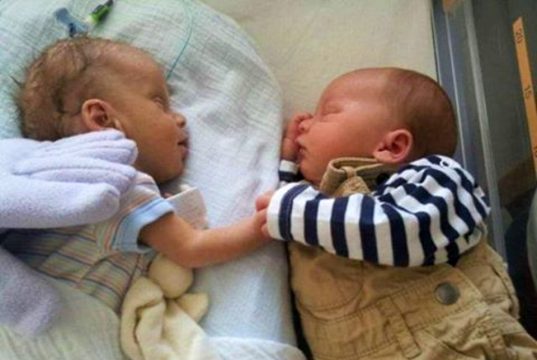 twins birth, preemie twins, Premature birth, babies, miracle, healthy babies, how to make birth easy, easy birth,