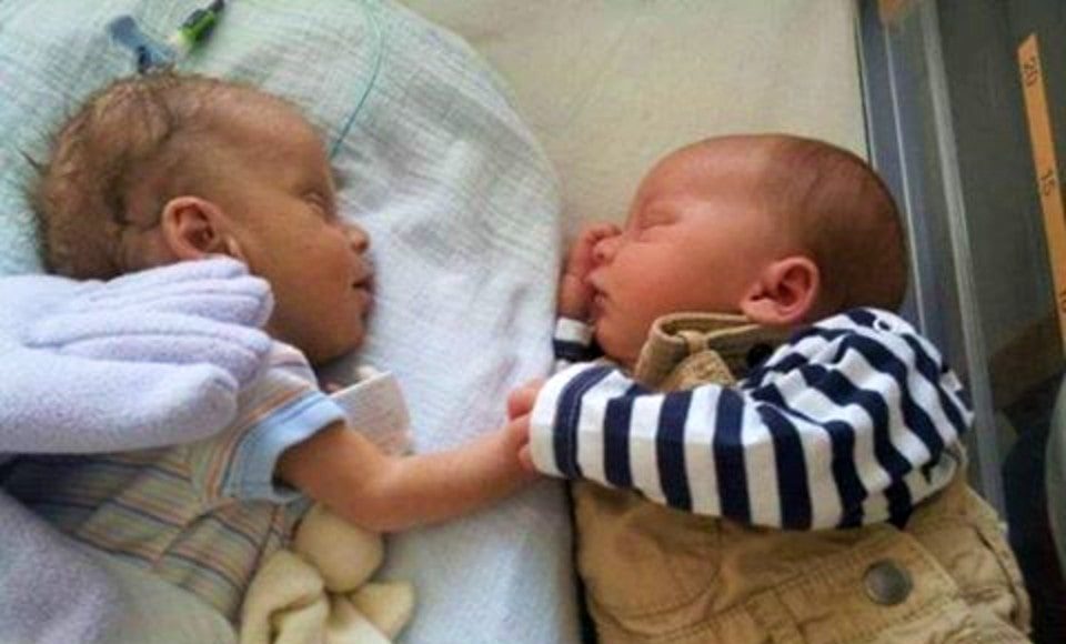twins birth, preemie twins, Premature birth, babies, miracle, healthy babies, how to make birth easy, easy birth,